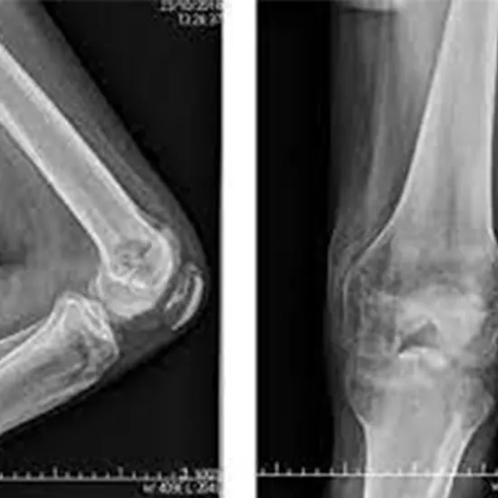 ncct wrist joint scan